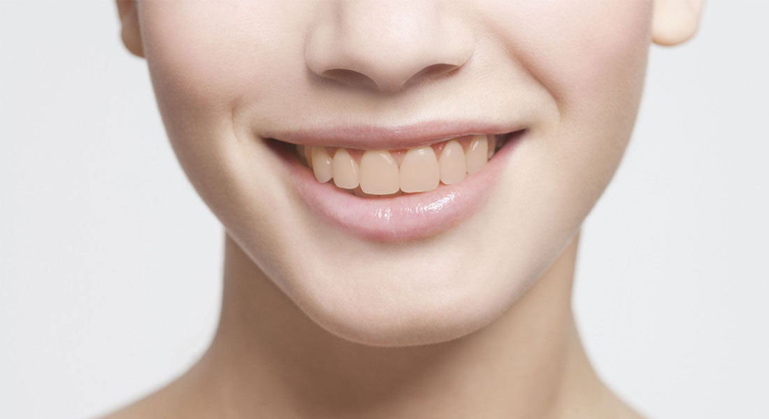before Penn Dental and Implant Center - Dentist in Dallas