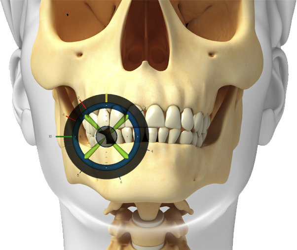 Penn Dental and Implant Center Dentist in Dallas